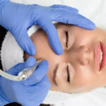 A Person Undergoing Microdermabrasion