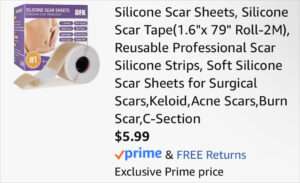Checkout page of DFK Silicone Scar Tape