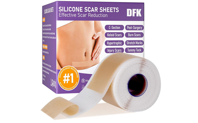 Silicone Scar Sheets