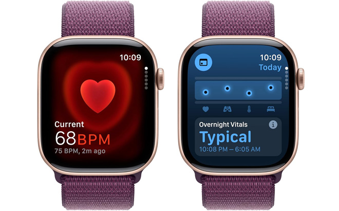 Apple Watch Series 10 Apple Watch Series 10